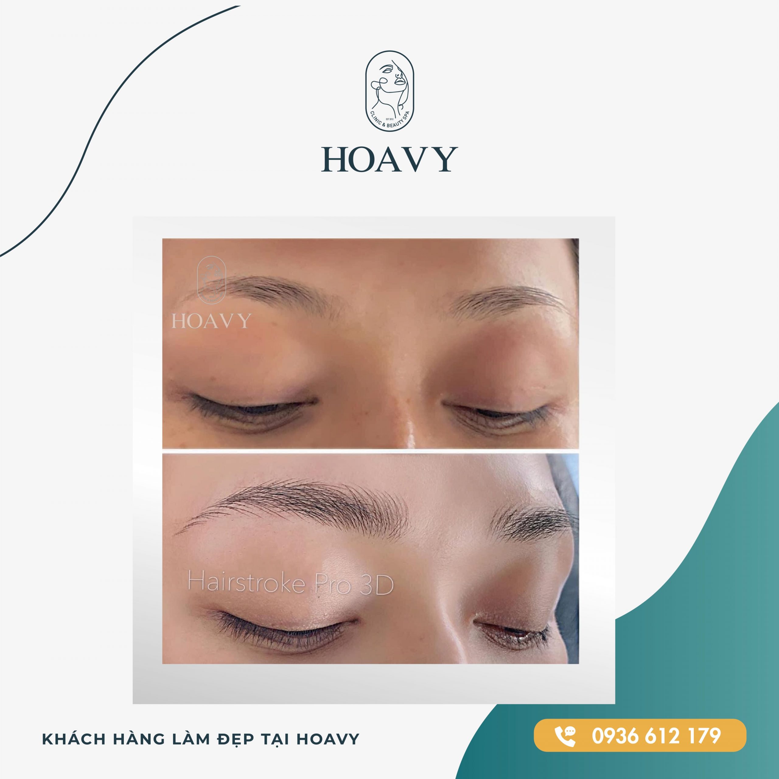 thammyhoavy.vn hinh anh khach hang lam dep mat tai hoa vy hai phong quang ninh scaled