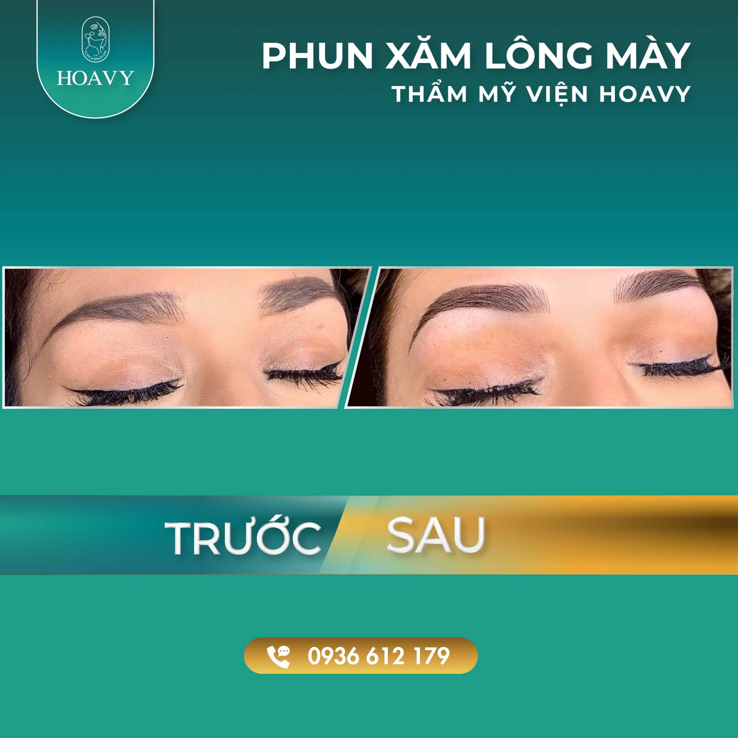 thammyhoavy.vn hinh anh khach hang lam dep tai hoa vy hai phong quang ninh phun xam long may dep 2 scaled