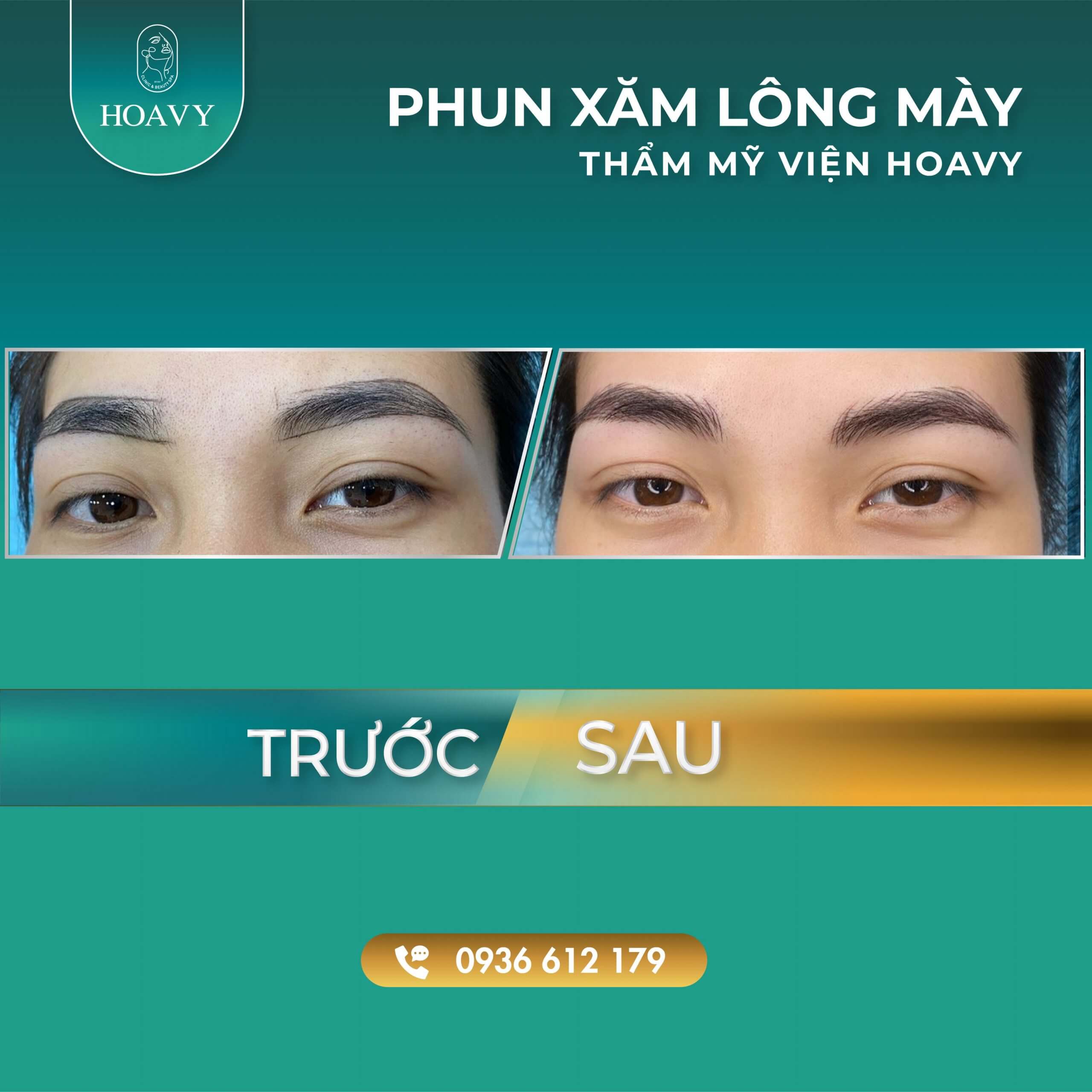 thammyhoavy.vn hinh anh khach hang lam dep tai hoa vy hai phong quang ninh phun xam long may dep 3 scaled