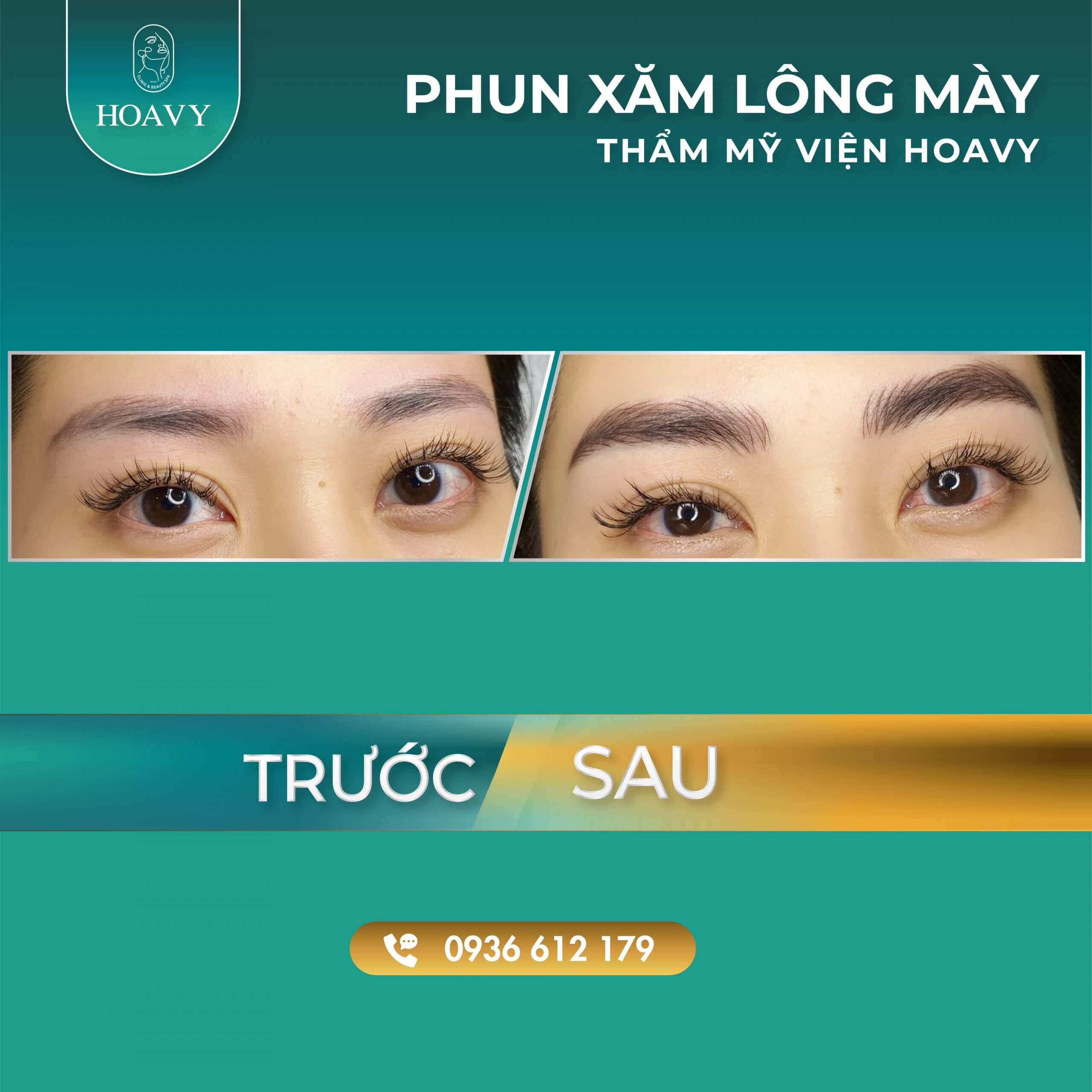 thammyhoavy.vn hinh anh khach hang lam dep tai hoa vy hai phong quang ninh phun xam long may dep 4 scaled