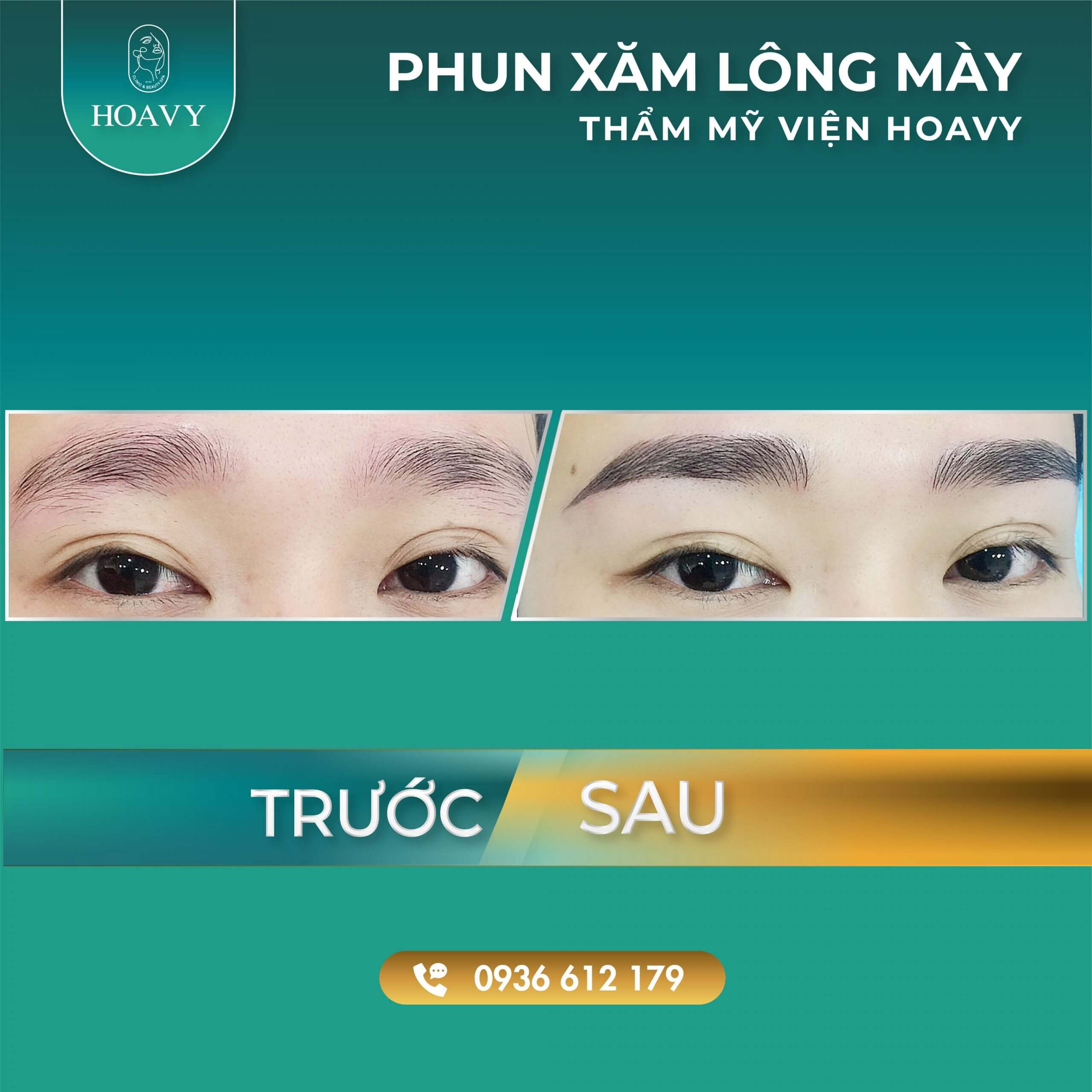 thammyhoavy.vn hinh anh khach hang lam dep tai hoa vy hai phong quang ninh phun xam long may dep scaled