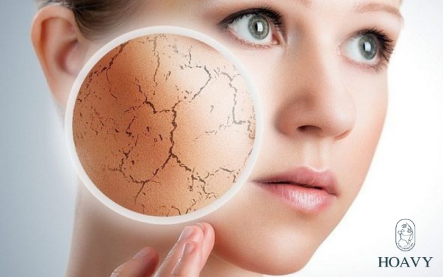 tay te bao chet cho da bi mun