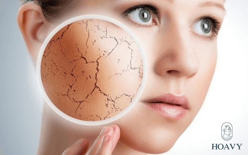 tay te bao chet cho da bi mun