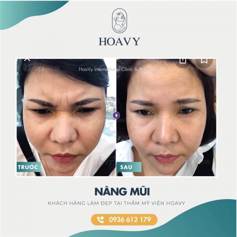 tham my vien quang ninh