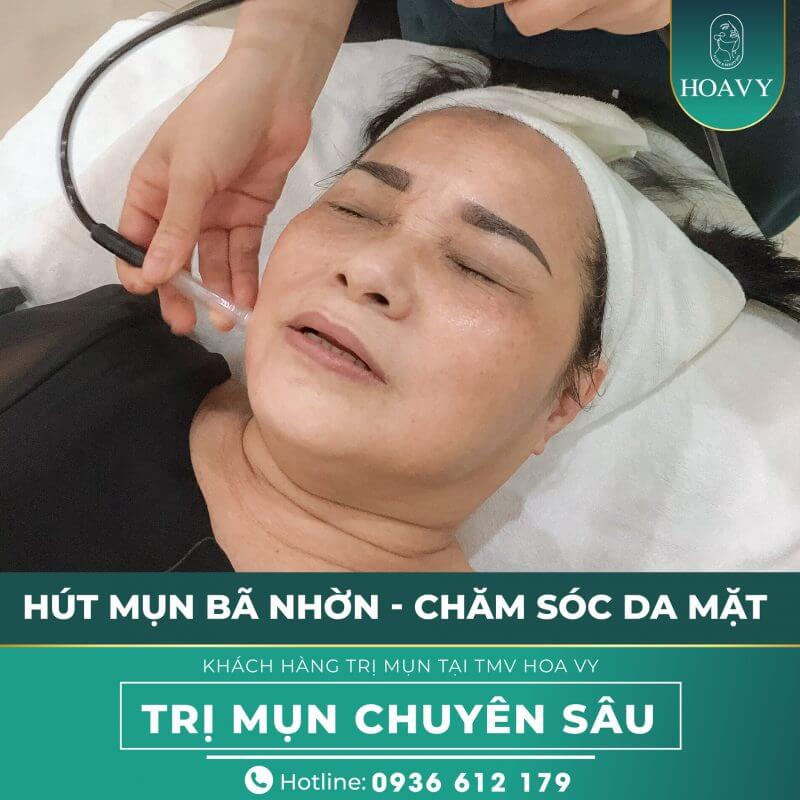 tham my vien ha long