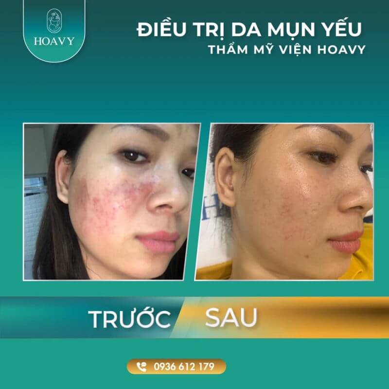 tham my vien quang ninh