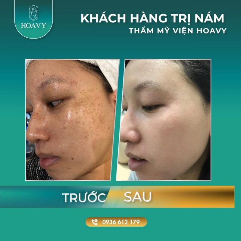 tham my vien ha long