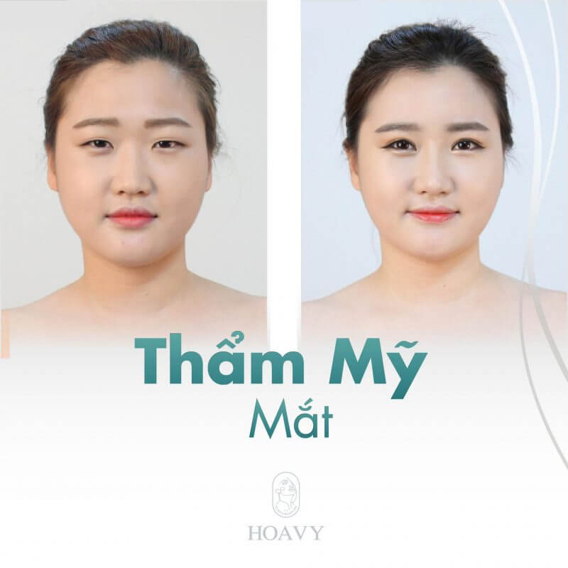 tham my vien quang ninh