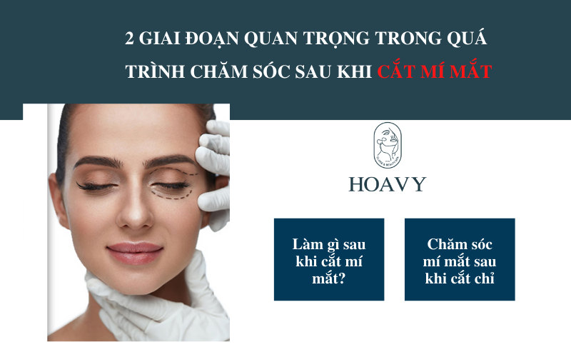 cham soc sau khi cat mi mat