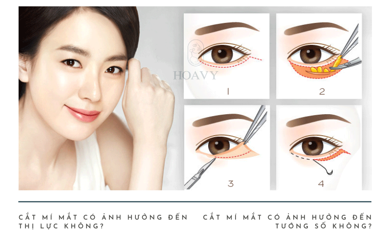 cat mi mat co anh huong gi khong