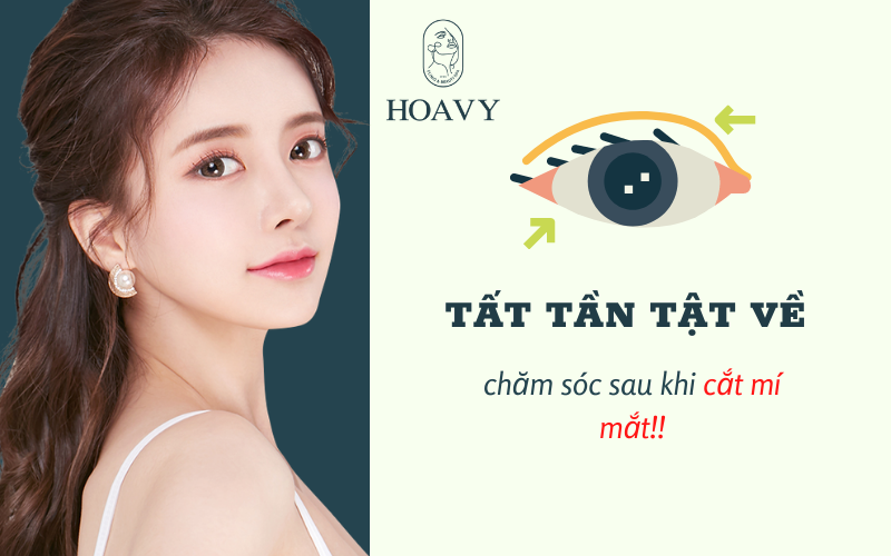 cham soc sau khi cat mi mat