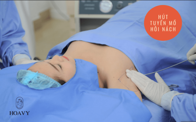 hut tuyen mo hoi nach tri hoi nach noi soi tri hoi nach tai hai phong tri hoi nach vinh vien tri hoi nach triet de chi phi tri hoi nach