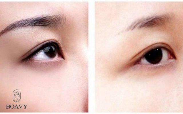 xoa xam long may tai nha hut xoa muc xam long may phun xam tham mỹ phun mi mo trong dich vu phun mi mo trong tai hai phong dich vu phun mi phun xam dieu khac phun mi mo trong het bao nhieu tien bao gia phun mi mo trong phun xam dieu khac phun tan bot long may phun may tan bot phun tan bot long may tai hai phong dia chi phun may tan bot uy tin chat luong phun xam tham my phun xam dieu khac dieu khac long mayphun moi phu bong collagen phun moi phu bong collagen tai hai phong phun xam dieu giac gia phun moi collagen chi phi phun mo collagen phun xam tham my phun may tan bot dieu khac chan may dia chi phun may tan bot gia phun may tan bot tai hai phong dich vu phun may tan bot tai quang ninhdich-vu-phun-xam-dieu-khac-tai-hai-phong