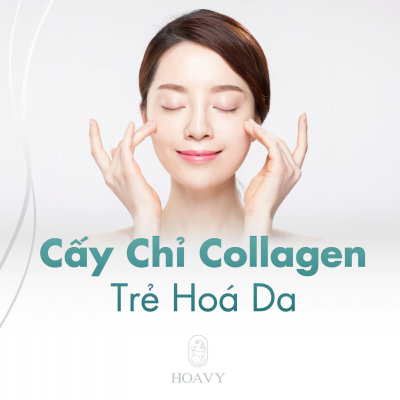 Trẻ hóa da với công nghệ cấy chỉ collagen