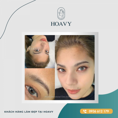 Đôi mắt hai mí to tròn được nhiều khách hàng ưa chuộng 