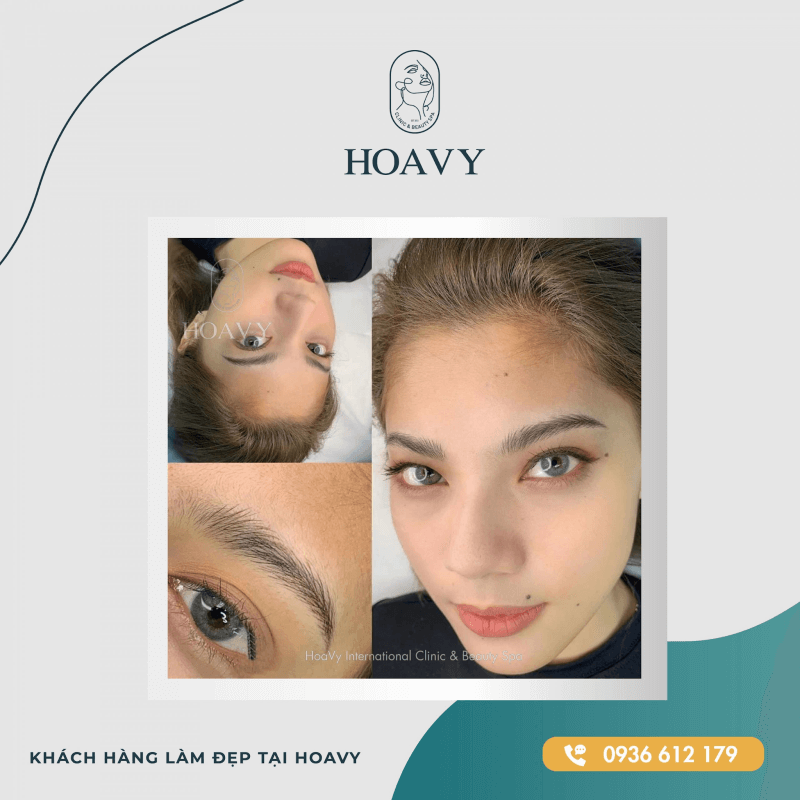 Đôi mắt hai mí to tròn được nhiều khách hàng ưa chuộng 