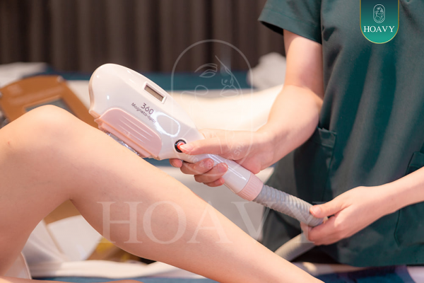 Quy trình triệt lông tại Hoa Vy chuyên nghiệp và an toàn