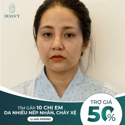 sự kiện trợ giá giảm giá dịch vụ trẻ hóa nhan sắc tại Hoa vy Spa Hải Phòng