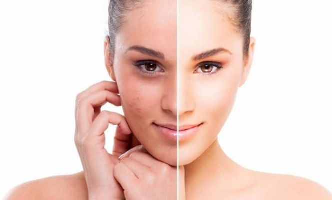 Làn da xuất hiện các vết loang lổ cảnh báo dấu hiệu lão hóa da 