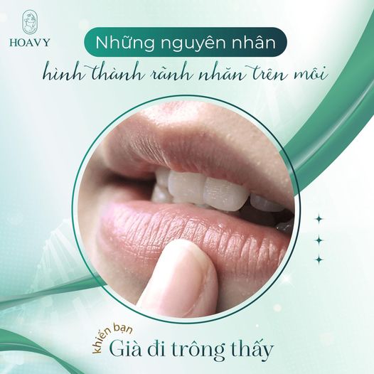 NHỮNG NGUYÊN NHÂN KHIẾN MÔI XUẤT HIỆN NHIỀU NẾP NHĂN - thẩm mỹ viện hoavy