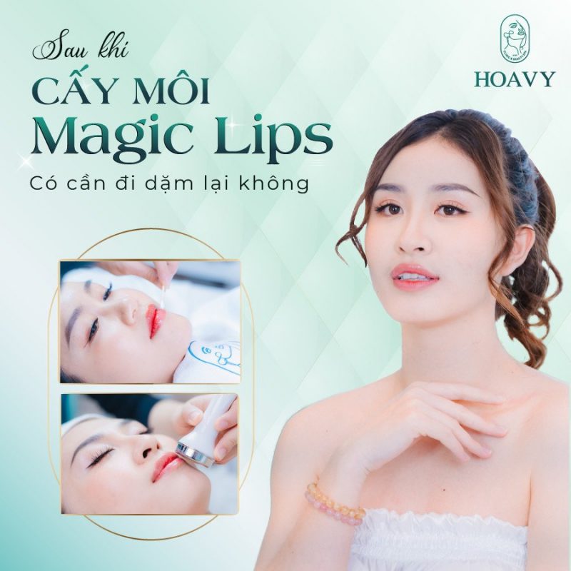 sau khi cấy môi magic líp có cần đi dặm lại không - thẩm mỹ viện hoavy