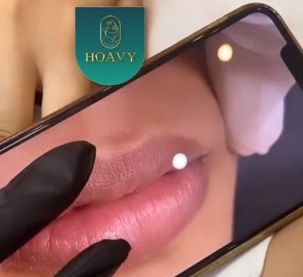 Xăm môi tại thẩm mỹ viện hoavy hải phòng uy tín chất lượng