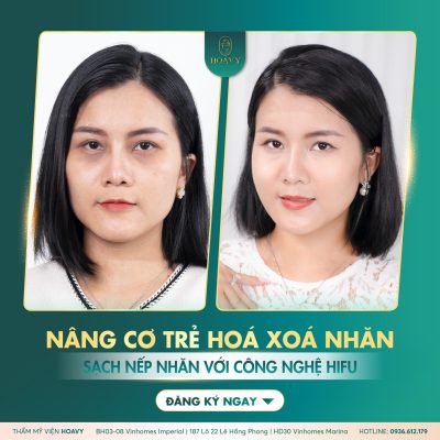 phuong phap cang bong da 4
