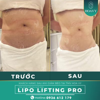 Phương pháp giảm béo hiệu quả giúp bạn sở hữu vòng eo như ý 1 phuong phap giam beo 4