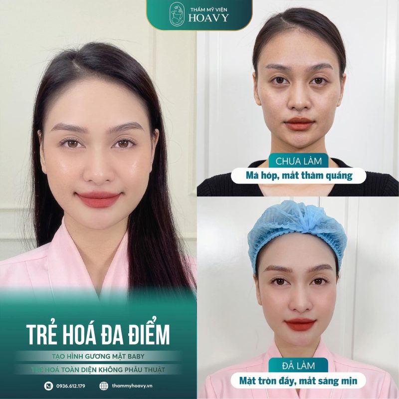 Bí quyết trẻ hóa da hiệu quả, nhanh chóng nên áp dụng ngay 1 tre hoa da 4