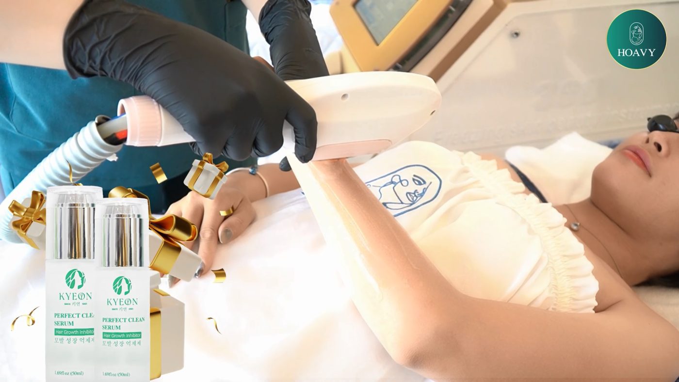 Triệt lông công nghệ diode laser an toàn và hiện đại nhất tại Thẩm mỹ viện Hoa Vy Hải Phòng