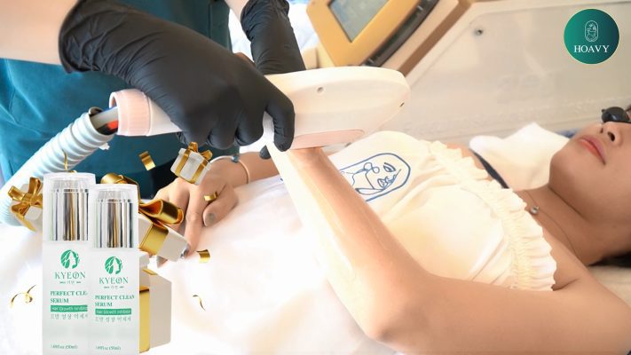 Triệt lông công nghệ diode laser an toàn và hiện đại nhất tại Thẩm mỹ viện Hoa Vy Hải Phòng