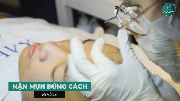 Trực quan 8 bước quy trình điều trị mụn tại Thẩm mỹ viện Hoa Vy Hải Phòng