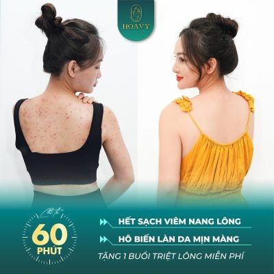 tri mun lung vinh vien