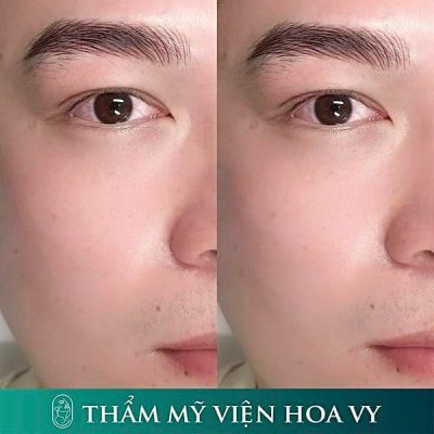 dieu khac chan may nam