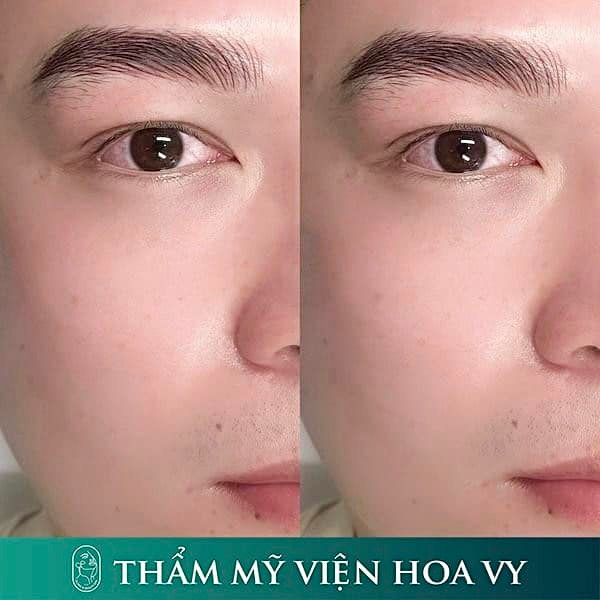 dieu khac chan may nam