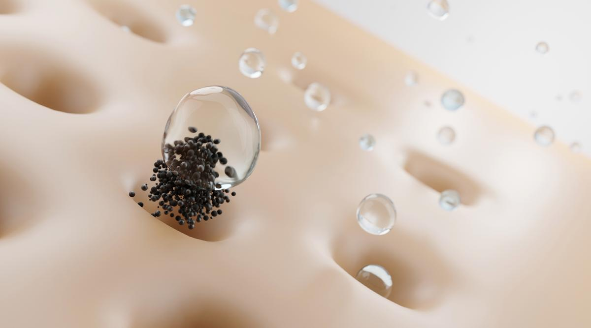 Giải đáp thắc mắc trị mụn đầu đen có nên lấy nhân mụn hay không? 1 tri mun dau den