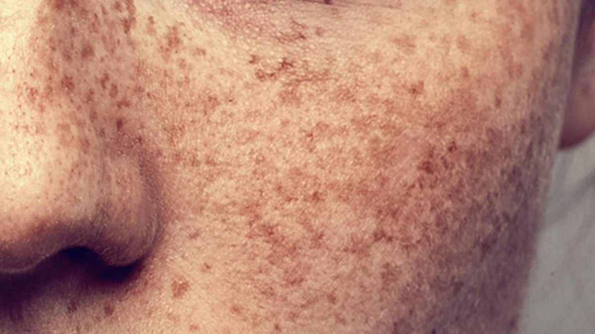 doi moi va tan nhang