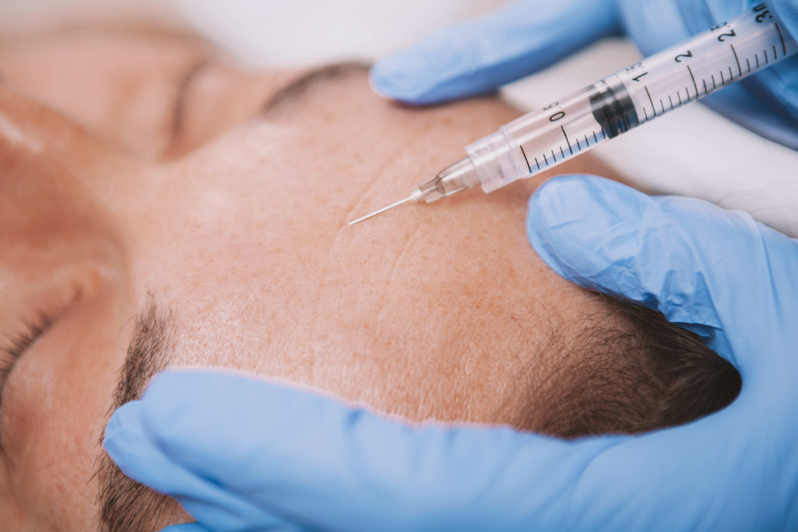 Tiêm filler và tiêm botox có công dụng không hoàn toàn giống nhau 