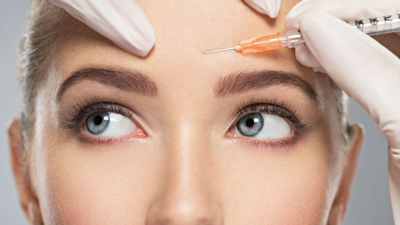 Botox phù hợp giải quyết các nếp nhăn tạo ra khi cơ mặt chuyển động 