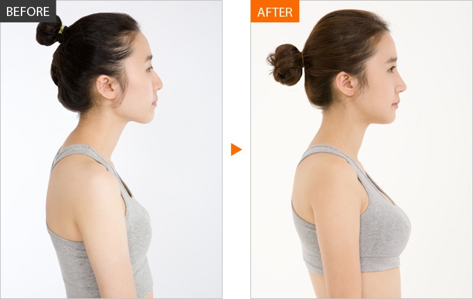 phuong phap nang nguc