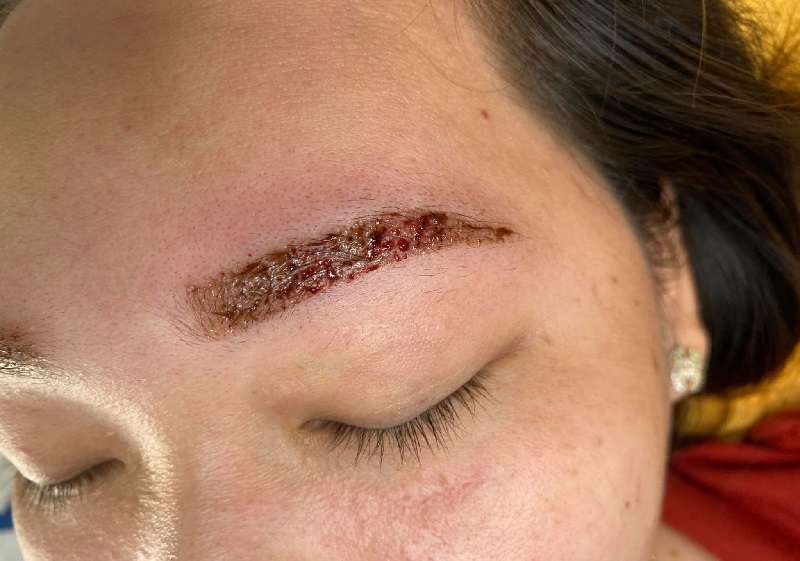 Phun mày bị hư gây ảnh hưởng đến tính thẩm mỹ