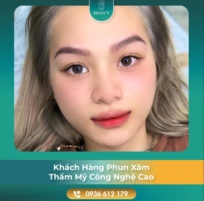 Thẩm Mỹ Hoa Vy cam kết về kết quả nhận được