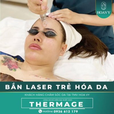 tre hoa da mat khong phau thuat