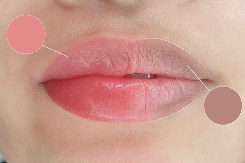 Khử thâm môi là dịch vụ nhận được nhiều đánh giá cao