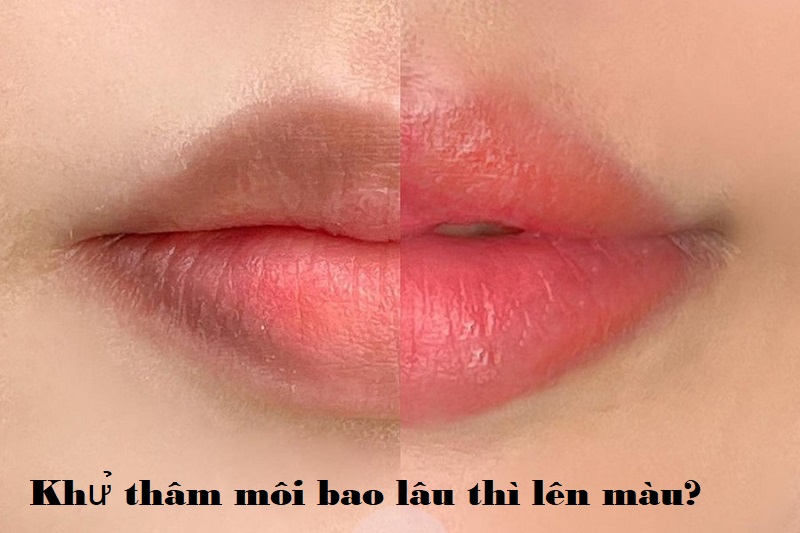 khu tham moi bao lau thi len mau