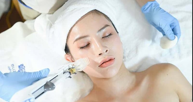 Cấy Collagen tươi Type 3 đang được nhiều chị em lựa chọn 