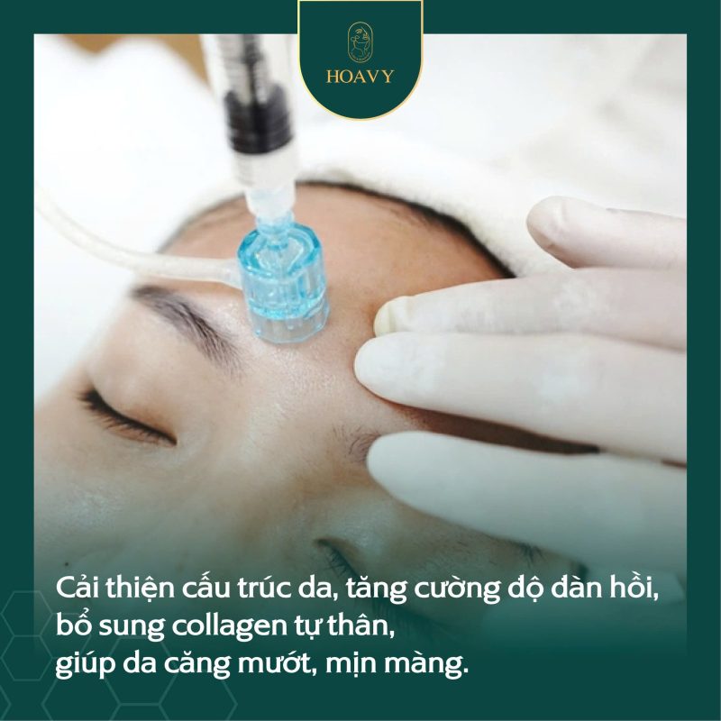 Căng da mặt không phẫu thuật – Làn da trẻ hóa, đẹp tự nhiên không dao kéo 4 Căng da mặt không phẫu thuật