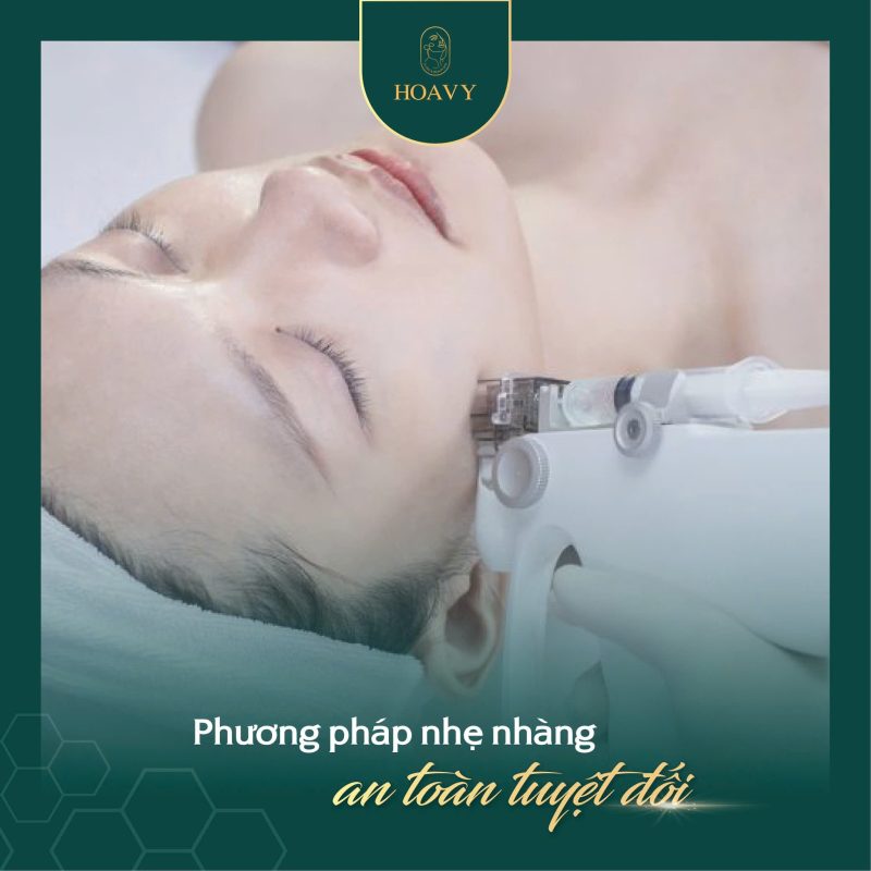 Căng da mặt không phẫu thuật – Làn da trẻ hóa, đẹp tự nhiên không dao kéo 3 Căng da mặt không phẫu thuật