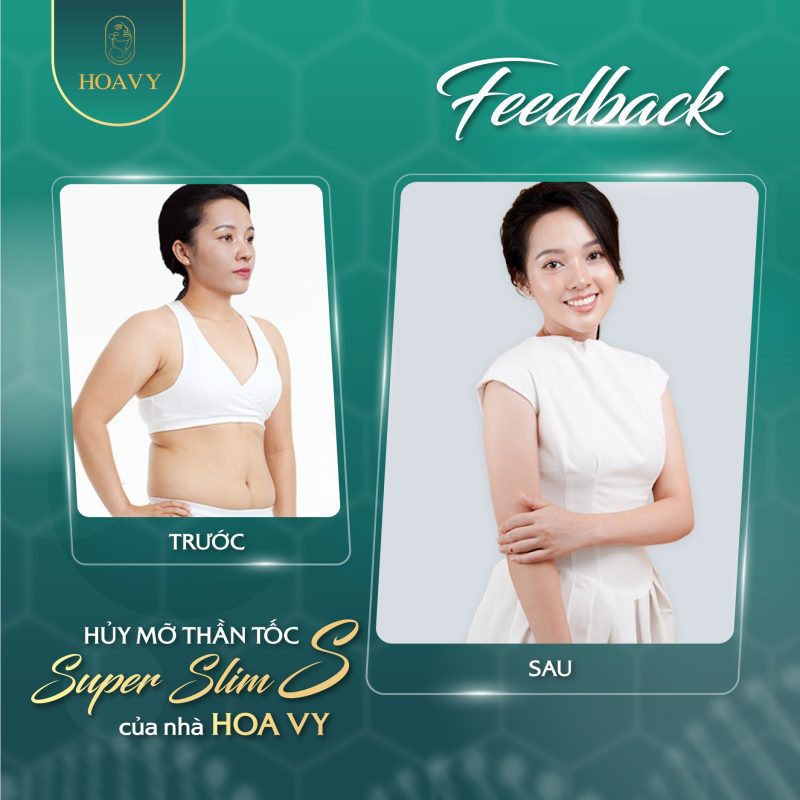 Hiệu quả giảm mỡ bụng Hoa Vy