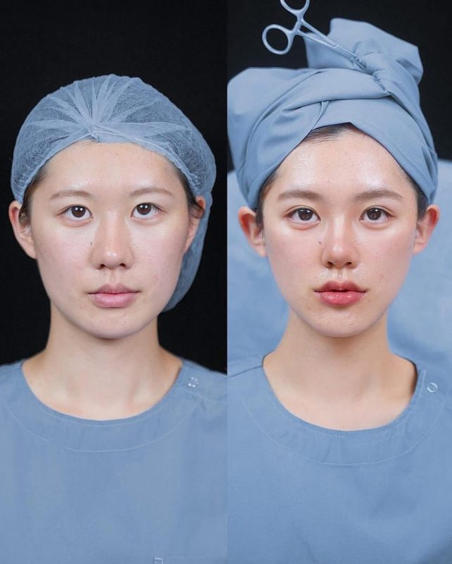 Nâng cơ táo Hải Phòng